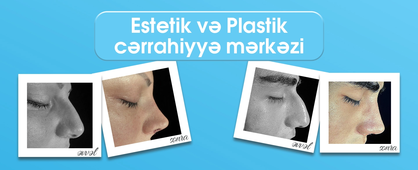 Estetik və Plastik Cərrahiyyə Mərkəzi